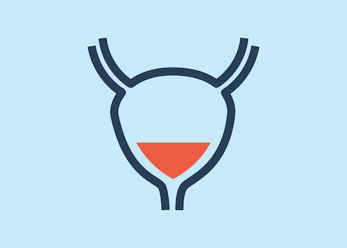 What’s the Difference Between Overactive Bladder, Urinary Incontinence & UTI?