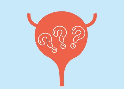 10 Common Overactive Bladder Questions