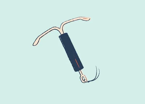 Is my IUD giving me BV?