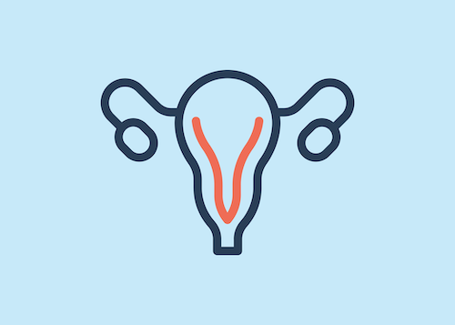 Can alcohol cause UTIs?