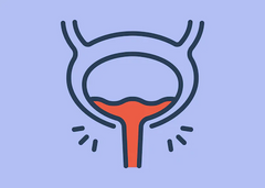 Image of The Difference Between UTIs and Embedded or Recurrent UTIs