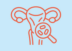 Image of What is BV? How to Stop the Cycle of Bacterial Vaginosis