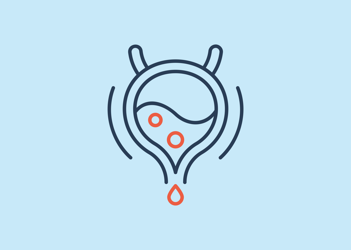 Overactive bladder (OAB): Symptoms and causes